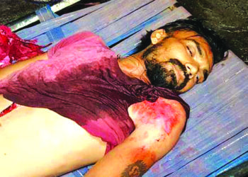 પ્લાસ્ટિકની ફેકટરીમાં કામદારનું અકસ્માતે ઇજા થતાં મોત