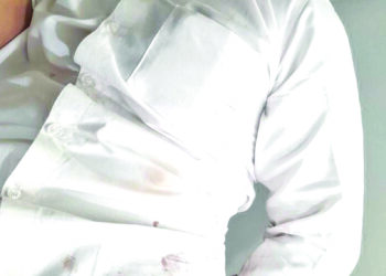 મારુતિ ઈમ્પેક્ષના મેનેજરને રત્નકલાકારે છરીના ૩ ઘા ઝીકી દીધા