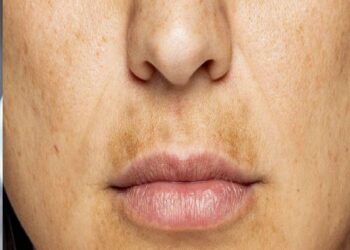 Dark Upper Lips: હોઠના ઉપરના ભાગ કાળા દેખાઈ છે? આ ઘરગથ્થુ ઉપચારથી કાળાશ દૂર થશે