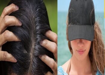 White Hair: સફેદ વાળને કારણે માથું ઢાંકવાની ફરજ પડી રહી છે, કાળા વાળ મેળવવા માટે અપનાવો આ રીતો